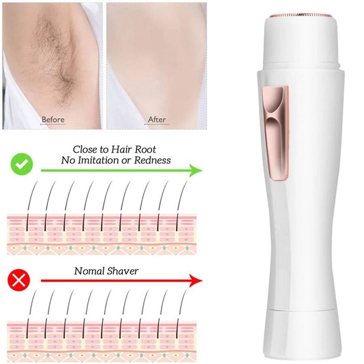 Facial epilator for women face and body hair removal compact grooming device-7